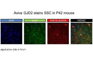 Image no. 2 for anti-Gap Junction Protein, delta 2, 36kDa (GJD2) (Middle Region) antibody (ABIN2774866) (GJD2 antibody  (Middle Region))