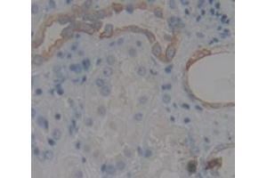 Figure. (PLXNB1 antibody  (AA 1780-2042))