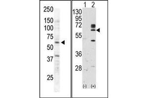 Image no. 2 for anti-RYK Receptor-Like Tyrosine Kinase (RYK) (AA 150-200) antibody (ABIN359937)