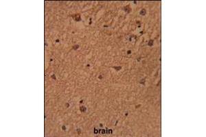 Formalin-fixed and paraffin-embedded human brain reacted with HSPC142 Antibody , which was peroxidase-conjugated to the secondary antibody, followed by DAB staining.