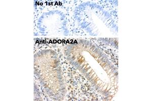 Immunohistochemistry (IHC) image for anti-Adenosine A2a Receptor (ADORA2A) (C-Term) antibody (ABIN7272985) (Adenosine A2a Receptor antibody  (C-Term))