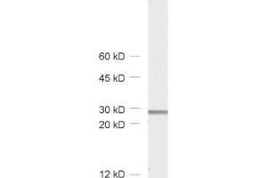 dilution: 1 : 1000, sample: rat brain homogenate (Calretinin antibody)