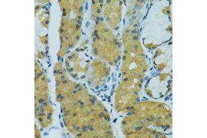 Immunohistochemistry of paraffin-embedded human stomach using CYP2B6 antibody (ABIN5997556) at dilution of 1/100 (40x lens).