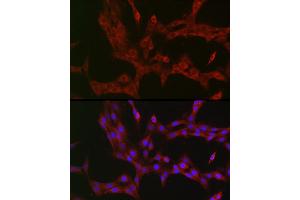 Immunofluorescence analysis of PC-12 cells using NKIR Rabbit pAb (ABIN7268903) at dilution of 1:100 (40x lens). (NKIRAS1 antibody  (AA 118-192))