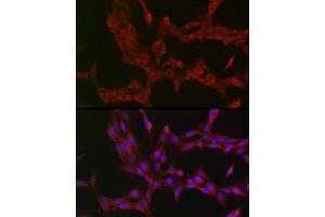 Immunofluorescence analysis of PC-12 cells using NKIR Rabbit pAb (ABIN7268903) at dilution of 1:100 (40x lens).