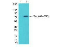 Western blot analysis of extracts from 293 cells (Lane 2), using Tau (Ab-396) antiobdy. (MAPT antibody  (Ser396))