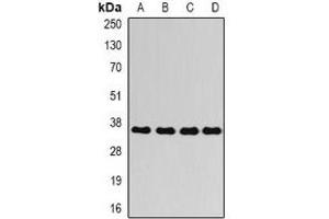 Western blot analysis of AKR1C4 expression in A549 (A), SW620 (B), mouse lung (C), rat liver (D) whole cell lysates. (AKR1C4 antibody)