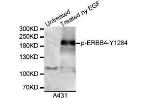 Western blot analysis of extracts of A431 cell line, using Phospho-HER4-Y1284 antibody. (ERBB4 antibody  (pTyr1284))