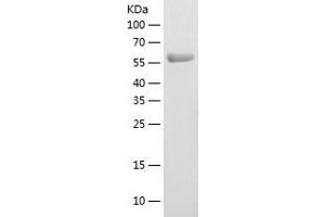 ASPSCR1 Protein (AA 1-553) (His tag)