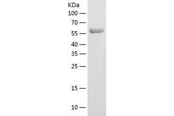 ASPSCR1 Protein (AA 1-553) (His tag)