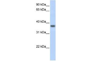 WB Suggested Anti-TMEM173 Antibody Titration:  0. (STING/TMEM173 antibody  (Middle Region))