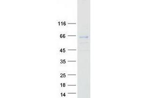 Validation with Western Blot