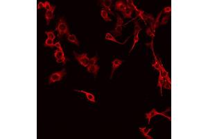 ABIN6267341 staining NIH-3T3 by IF/ICC. (c-MET antibody  (pTyr1234))