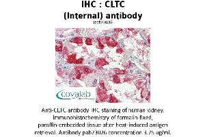 Image no. 2 for anti-Clathrin Heavy Chain (CLTC) (C-Term), (Internal Region) antibody (ABIN1733162) (Clathrin Heavy Chain (CLTC) (C-Term), (Internal Region) antibody)