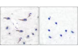 Immunohistochemistry analysis of paraffin-embedded human brain, using MARCKS (Phospho-Ser163) Antibody. (MARCKS antibody  (pSer163))