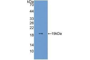 Detection of Recombinant ESM1, Human using Polyclonal Antibody to Endothelial Cell Specific Molecule 1 (ESM1) (ESM1 antibody  (AA 20-184))