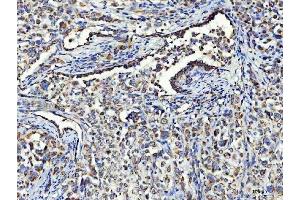 IHC analysis of Asparagine synthetase/ASNS using anti-Asparagine synthetase/ASNS antibody (ABIN7599465). (Asparagine Synthetase antibody  (AA 1-531))