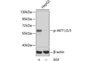 Western blot analysis of extracts HepG2 cells using Phospho-AKT1(Y315)/AKT2(Y316)/AKT3(Y312) Polyclonal Antibody. (AKT1 antibody  (pTyr312, pTyr315, pTyr316))