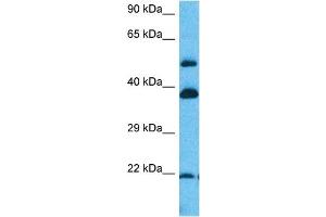 Host:  Rabbit  Target Name:  ERI1  Sample Tissue:  Human Lung Tumor lysates  Antibody Dilution:  1ug/ml (ERI1 antibody  (N-Term))