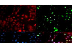 Immunofluorescence analysis of GFP-RNF168 transgenic U2OS cells using POLK Polyclonal Antibody (POLK antibody)