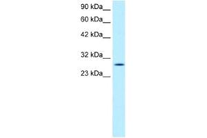 RGS16 antibody used at 1 ug/ml to detect target protein. (RGS16 antibody  (C-Term))