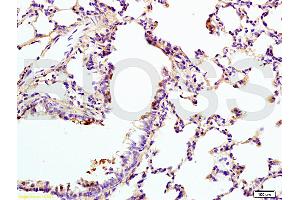 Lane 1: rat brain lysates Lane 2: human colon carcinoma lysates probed with Anti VIP Receptor 1/VAPC1 Polyclonal Antibody, Unconjugated (ABIN872880) at 1:200 in 4 °C. (VIPR1 antibody  (AA 351-457))