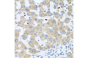 Immunohistochemistry of paraffin-embedded human liver using NMU antibody (ABIN6290689) at dilution of 1:100 (40x lens). (Neuromedin U antibody)
