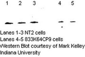 Image no. 1 for anti-Nudix (Nucleoside Diphosphate Linked Moiety X)-Type Motif 1 (NUDT1) (C-Term) antibody (ABIN363382) (NUDT1 antibody  (C-Term))