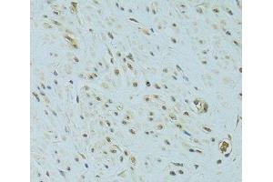 Immunohistochemistry (Paraffin-embedded Sections) (IHC (p)) image for anti-Nonhomologous End-Joining Factor 1 (NHEJ1) antibody (ABIN7261171)
