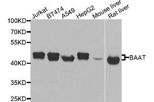 Western blot analysis of extracts of various cells, using BAAT antibody. (BAAT antibody)