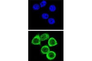 Confocal immunofluorescent analysis of PARP antibody with HeLa cells followed by Alexa Fluor 488-conjugated goat anti-rabbit lgG (green). (PARP1 antibody  (AA 183-214))