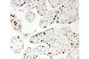 IHC-P: PARP antibody testing of human placenta tissue (PARP1 antibody  (AA 670-858))