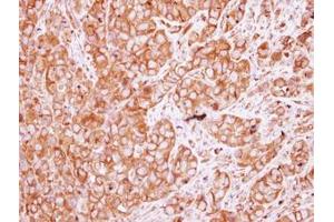 Image no. 1 for anti-Nicotinic Acetylcholine Receptor beta (CHRNB1) (AA 274-501) antibody (ABIN1497506) (CHRNB1 antibody  (AA 274-501))