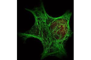 Immunofluorescence Microscopy of  Immunochemical's Anti-Keratin antibody () was used with  Dylight 488 goat anti-mouse 610-141-121 (shown in green) to detect Keratin by Immunofluorescence. (Keratin 6C antibody)