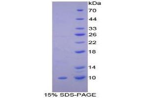 SDS-PAGE analysis of Rat Clara Cell Protein 16 Protein. (SCGB1A1 Protein)