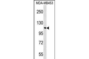 FB Antibody (C-term) (ABIN1537622 and ABIN2848766) western blot analysis in MDA-M cell line lysates (35 μg/lane). (FAM65B antibody  (C-Term))