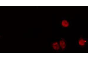 ABIN6274168 staining HeLa cells by IF/ICC. (MYF5 antibody  (N-Term))