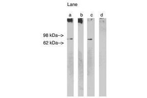 Image no. 1 for anti-Ceramide Synthase 1 (CERS1) antibody (ABIN793692)
