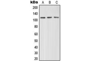 Western blot analysis of mGLUR4 expression in HeLa (A), mouse brain (B), rat brain (C) whole cell lysates. (Metabotropic Glutamate Receptor 4 antibody  (C-Term))