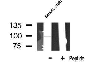 Western blot analysis of LTK expression in Mouse Brain lysate (LTK antibody  (Internal Region))