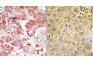 Image no. 1 for anti-G Protein-Coupled Receptor Kinase 7 (GRK7) (C-Term) antibody (ABIN360010) (GRK7 antibody  (C-Term))