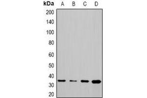Western blot analysis of CHIP expression in Hela (A), PC12 (B), COS7 (C), mouse liver (D) whole cell lysates. (STUB1 antibody)