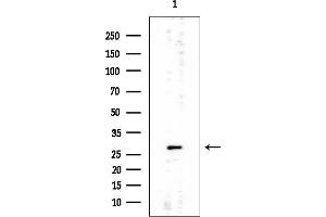 anti-Inhibitor of Growth Family, Member 5 (ING5) (Internal Region) antibody