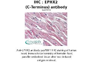 Image no. 1 for anti-Epoxide Hydrolase 2, Cytoplasmic (EPHX2) (C-Term) antibody (ABIN1734088) (EPHX2 antibody  (C-Term))