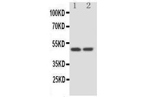 Anti-Kallistatin antibody, Western blotting Lane 1: HELA Cell Lysate Lane 2: SKOV Cell Lysate (SERPINA4 antibody  (C-Term))