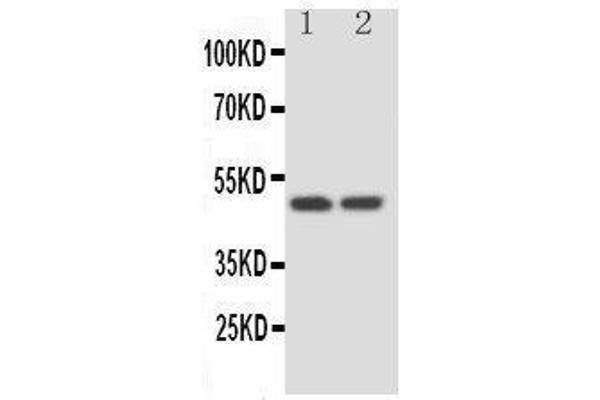 SERPINA4 Antikörper  (C-Term)