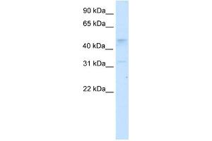 WB Suggested Anti-TCFAP2C Antibody Titration:  2. (TFAP2C antibody  (N-Term))