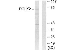 Western Blotting (WB) image for anti-Doublecortin-Like Kinase 2 (DCLK2) (N-Term) antibody (ABIN1849775) (DCLK2 antibody  (N-Term))