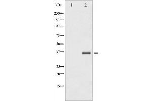 Western blot analysis of IkappaB-beta expression in TNF treated NIH-3T3 whole cell lysates,The lane on the left is treated with the antigen-specific peptide. (NFKBIB antibody  (N-Term))