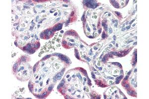 Anti-CYP26A1 antibody IHC of human placenta. (CYP26A1 antibody  (C-Term))